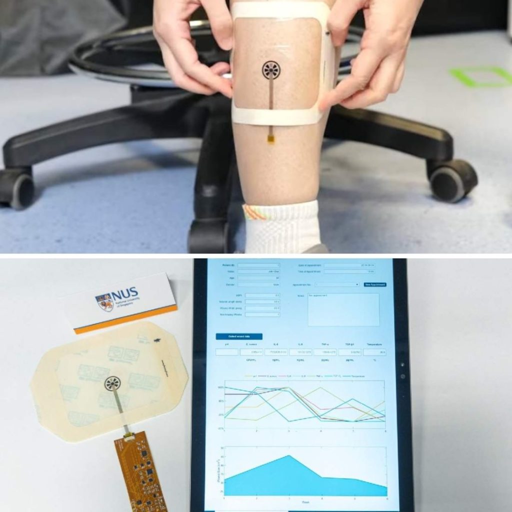 This Smart Bandage Monitors Aid Healing Chronic Wounds