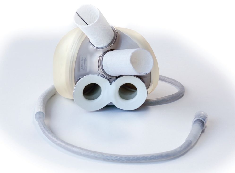 Carmat artificial heart bioprosthetic valves and veins