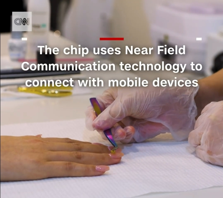 implanting microchip on manicured finger nail