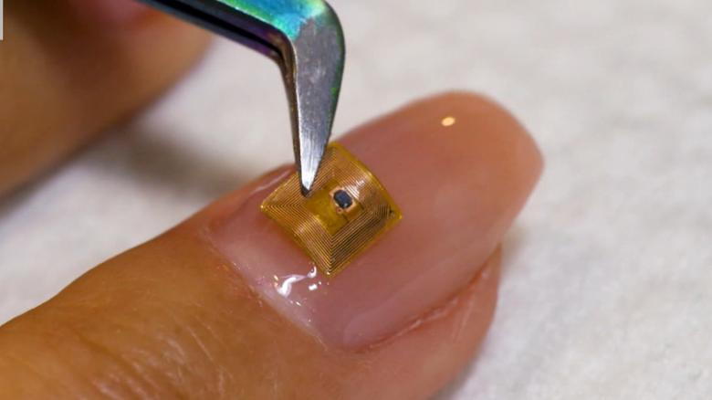 microchip implanted on fingernail