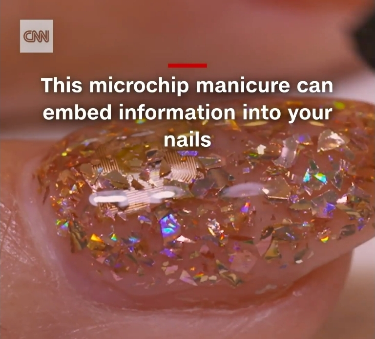 microchipped manicured implant