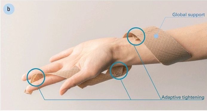 Adaptive tightening of 4D printed wrist splint