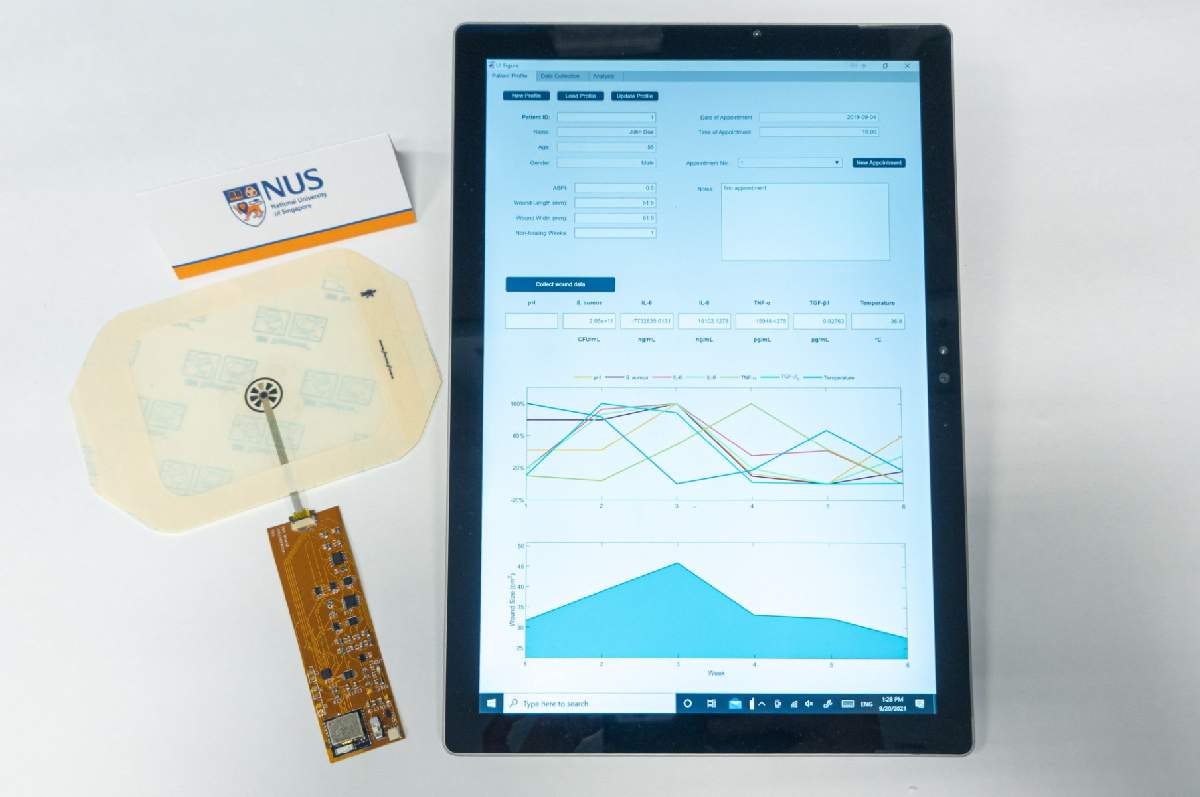 Smart bandage immunosensor and phone App