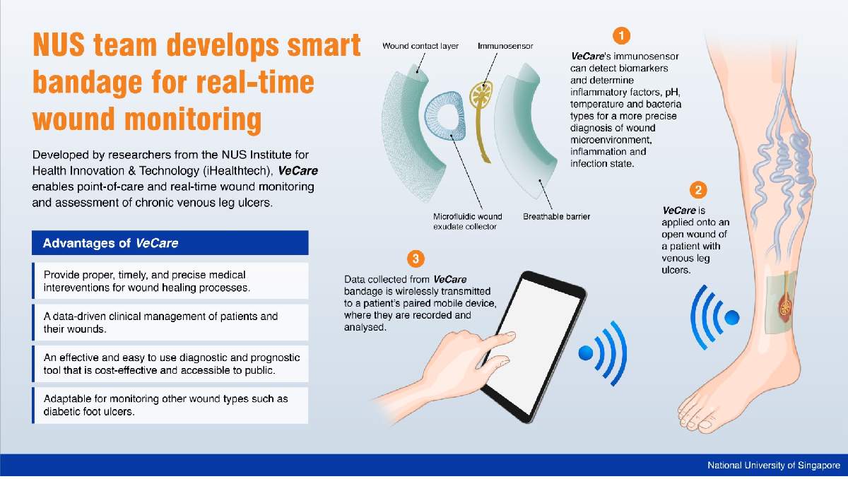 Smart bandage working infographic