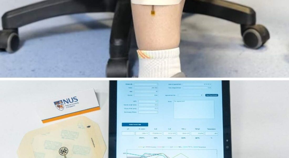 This Smart Bandage Monitors (& Aid Healing) Chronic Wounds