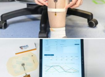 This Smart Bandage Monitors (& Aid Healing) Chronic Wounds