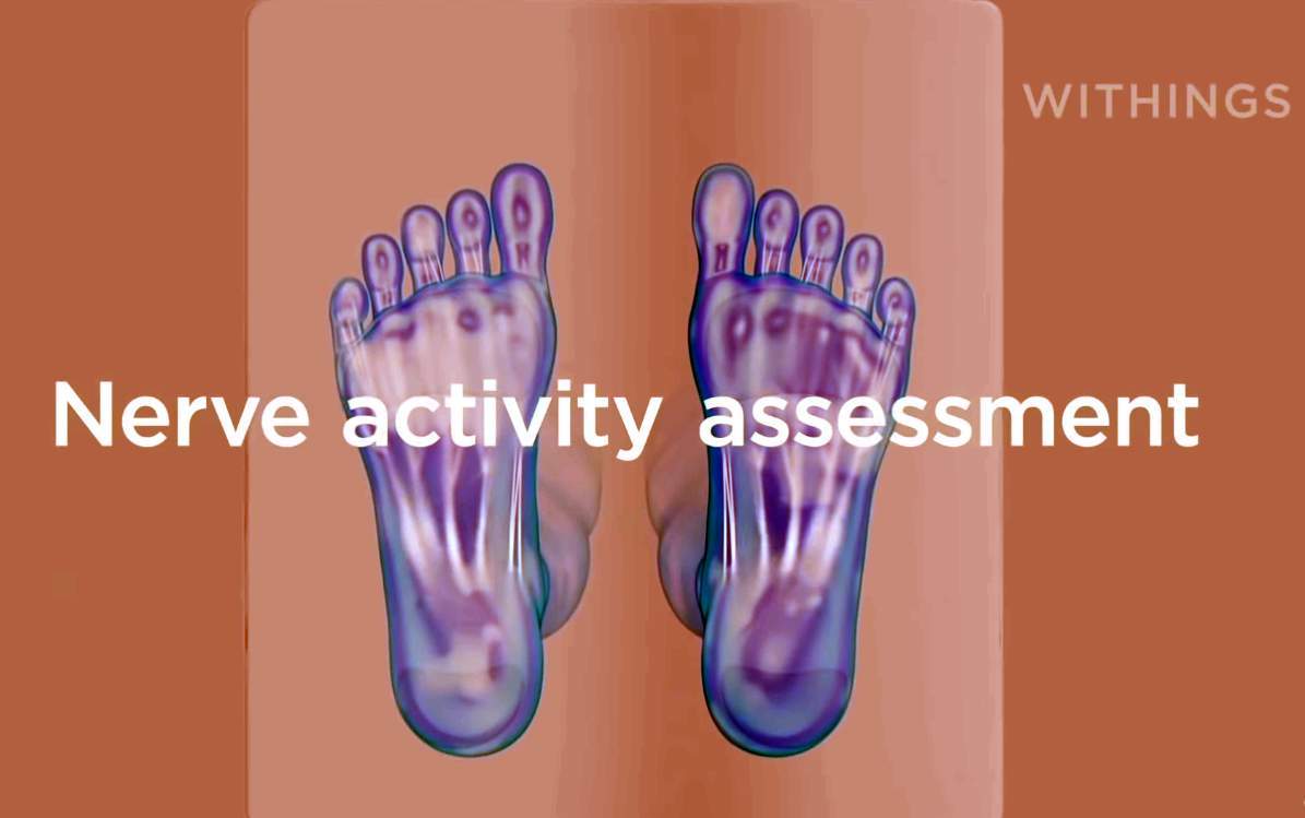 Nerve activity assessment with Withings body scan