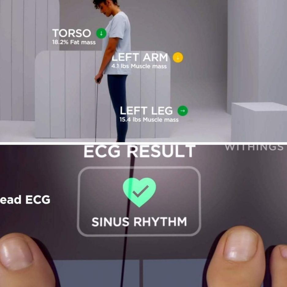 Taking ECG & Monitoring Vital Signs with Withings Body Scan