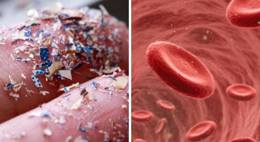 Microplastics Found In Human Blood | Is Our Health At Risk?