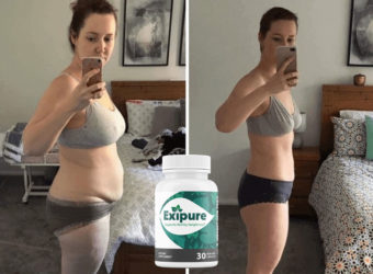 Exipure Reviews Before and After Transformation Pics